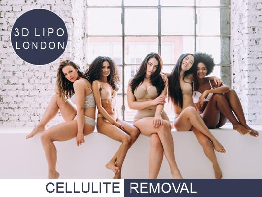 Cellulite removal